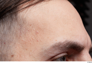  HD Face Skin Raul Conley face forehead skin pores skin texture 0001.jpg